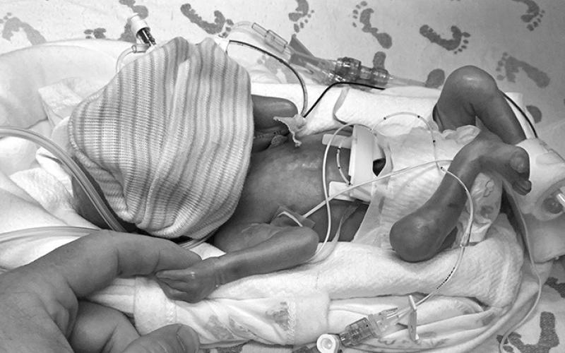 Courtesy Photo Garrett Haas was born at just 1 lb. 14 oz. at 26 weeks due to issues caused from high blood pressure.