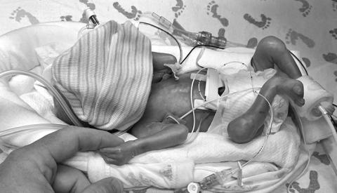 Courtesy Photo Garrett Haas was born at just 1 lb. 14 oz. at 26 weeks due to issues caused from high blood pressure.