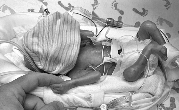Courtesy Photo Garrett Haas was born at just 1 lb. 14 oz. at 26 weeks due to issues caused from high blood pressure.